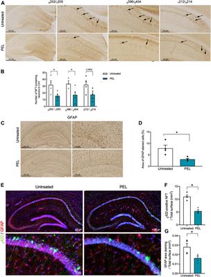 A ß-Secretase Modulator Decreases Tau Pathology and Preserves Short-Term Memory in a Mouse Model of Neurofibrillary Degeneration